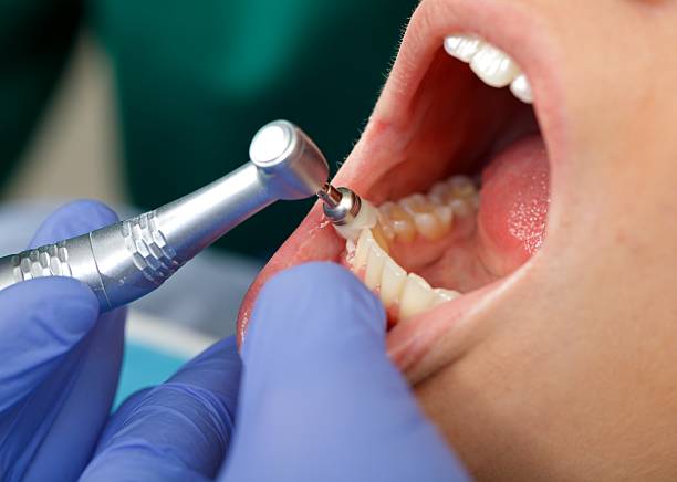 Oral Surgery in Parowan, UT